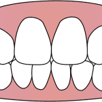 Dental composite